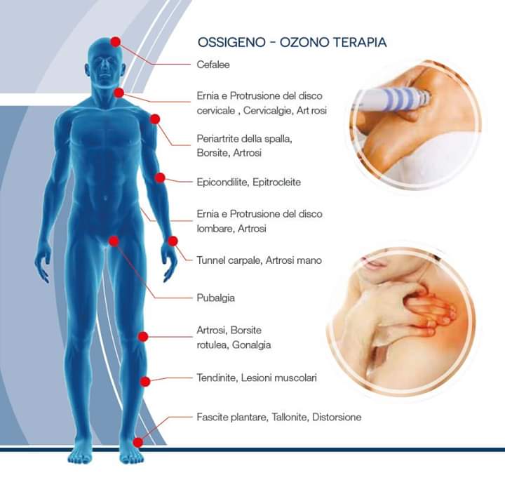 Ozono Terapia