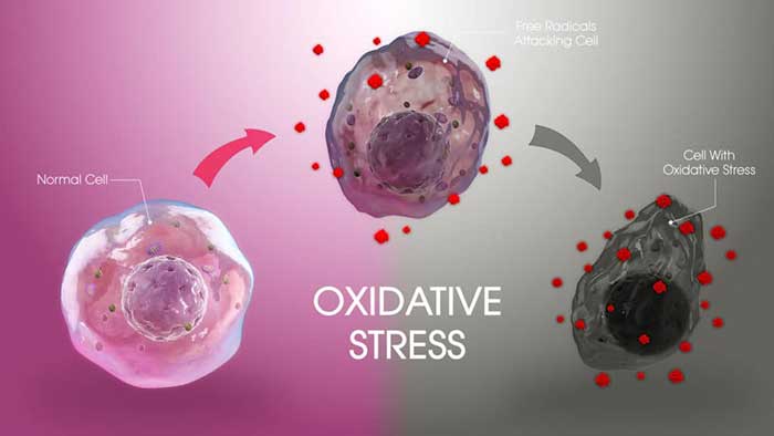 OZONOTERAPIA PER COMBATTERE LO STRESS OSSIDATIVO